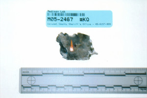 Exhibit-429-Cranial-Bone-Fragments-Outer-Defect-1024x680